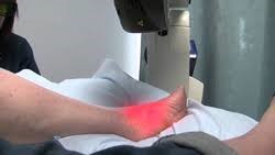 MLS Laser Therapy in Highland, UT